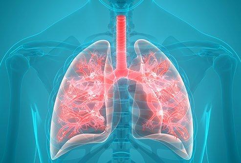 Breathing Easier: Expert Care for Respiratory Health and Lung Disease Management